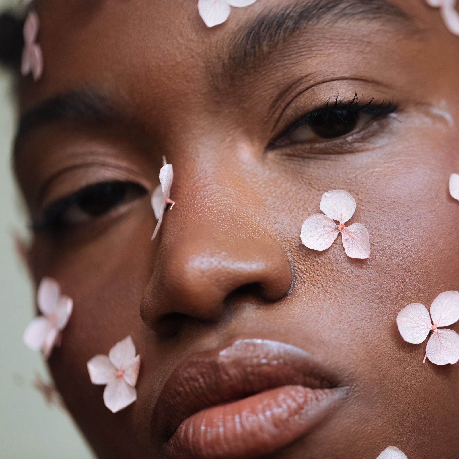 I Thought It Was Acne. Turns Out, It Was Lupus.
