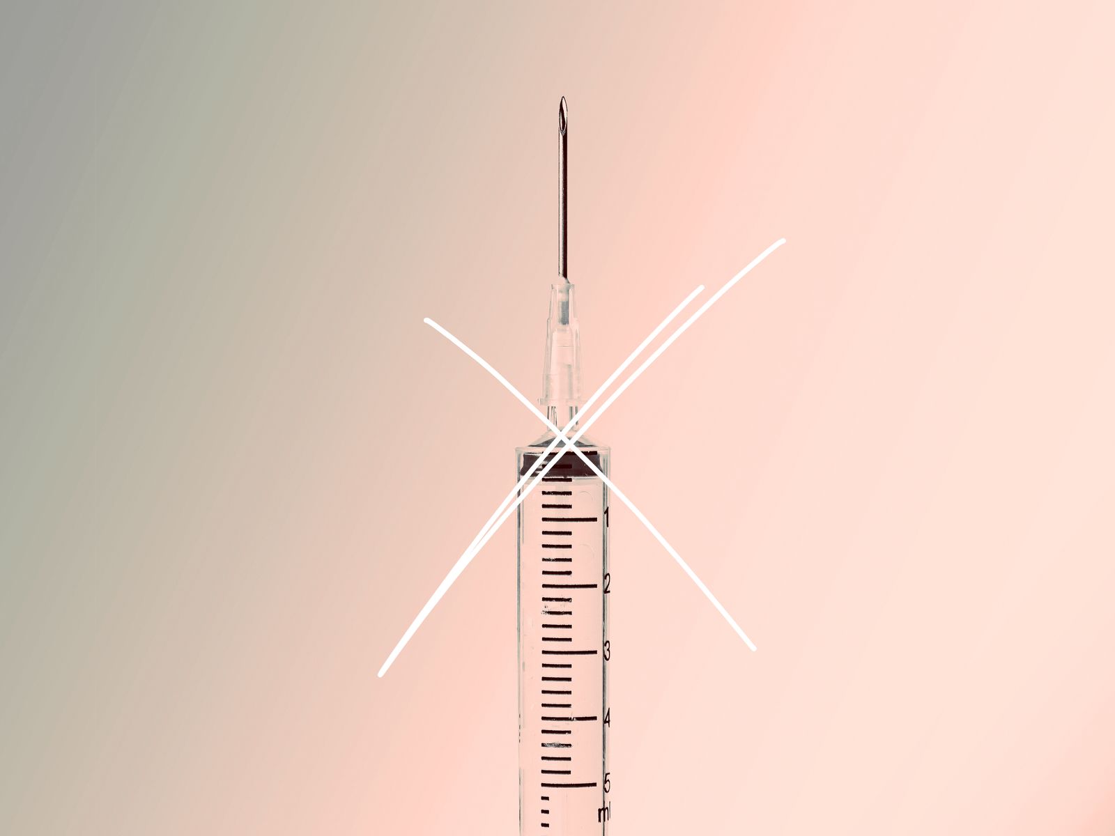 What Happens When You’ve Gotten Filler for Years—and Then Stop?