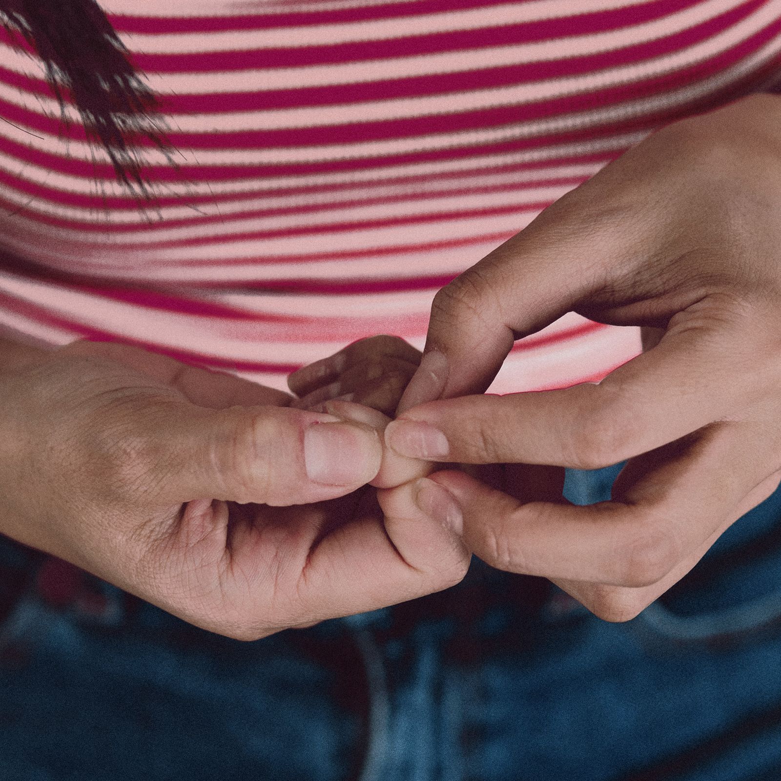 Nail Psoriasis: Causes, Symptoms, and How to Treat It