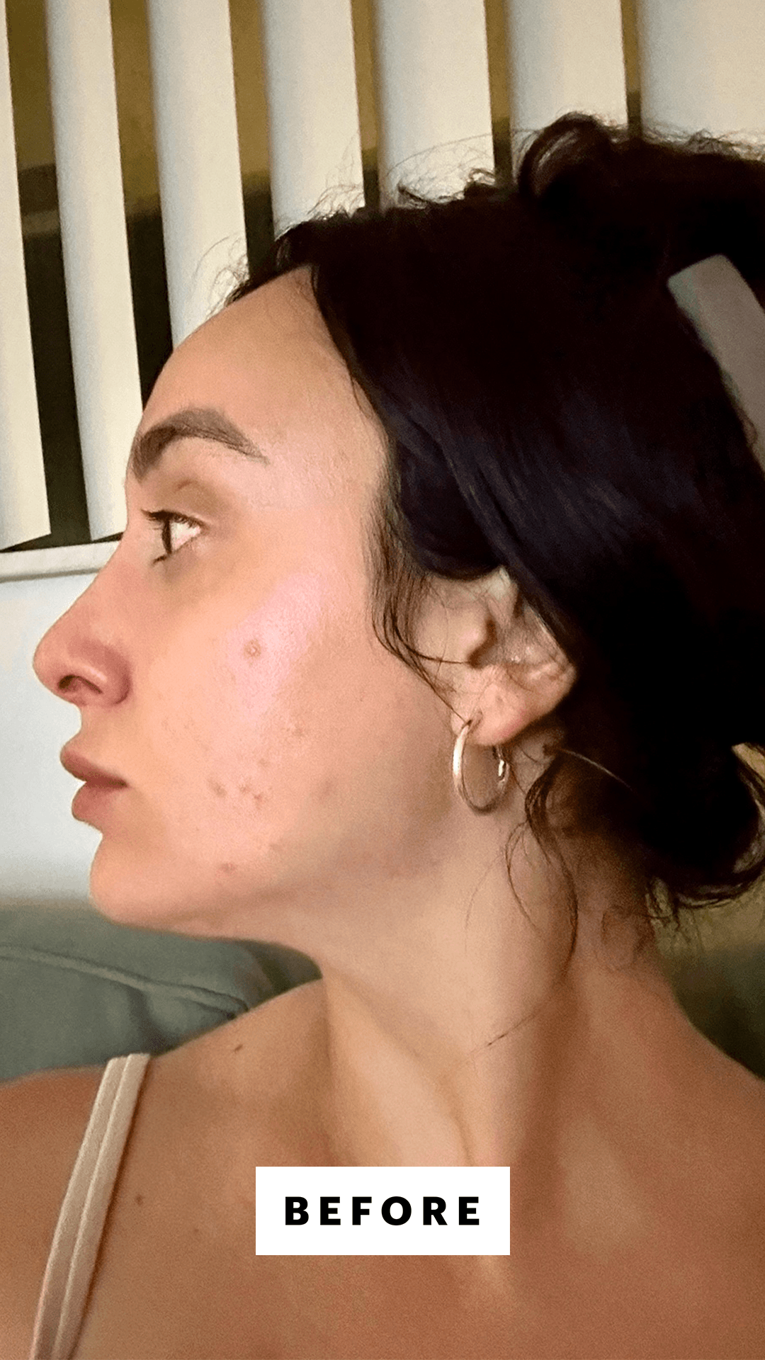 Selfie of Trakoshis before applying the SkinCeuticals Discoloration Defense